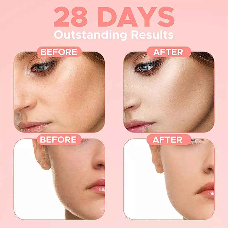 4-In-1 Hylauronic Acid Facial Serum - My Store