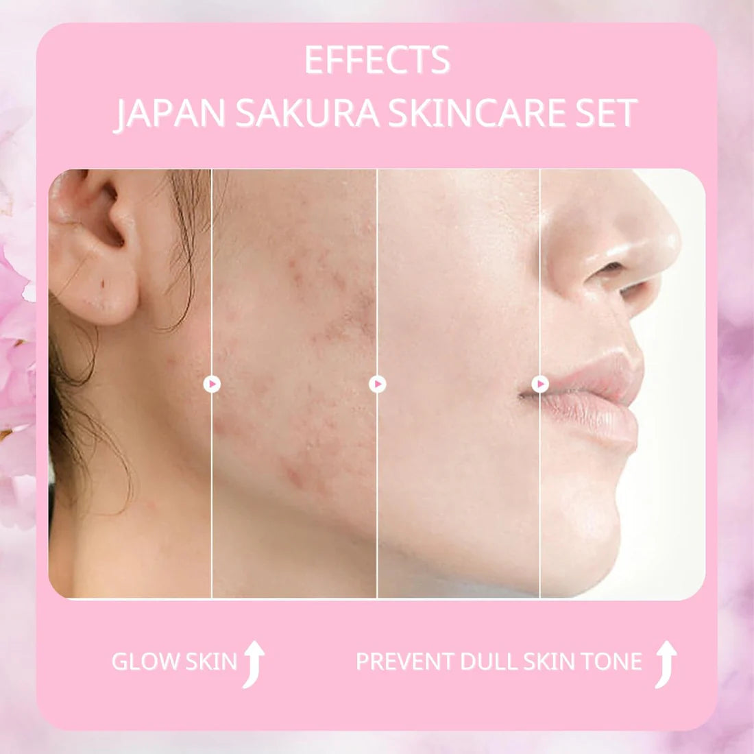 4-Pc Sakura Face Skin Care Set - My Store