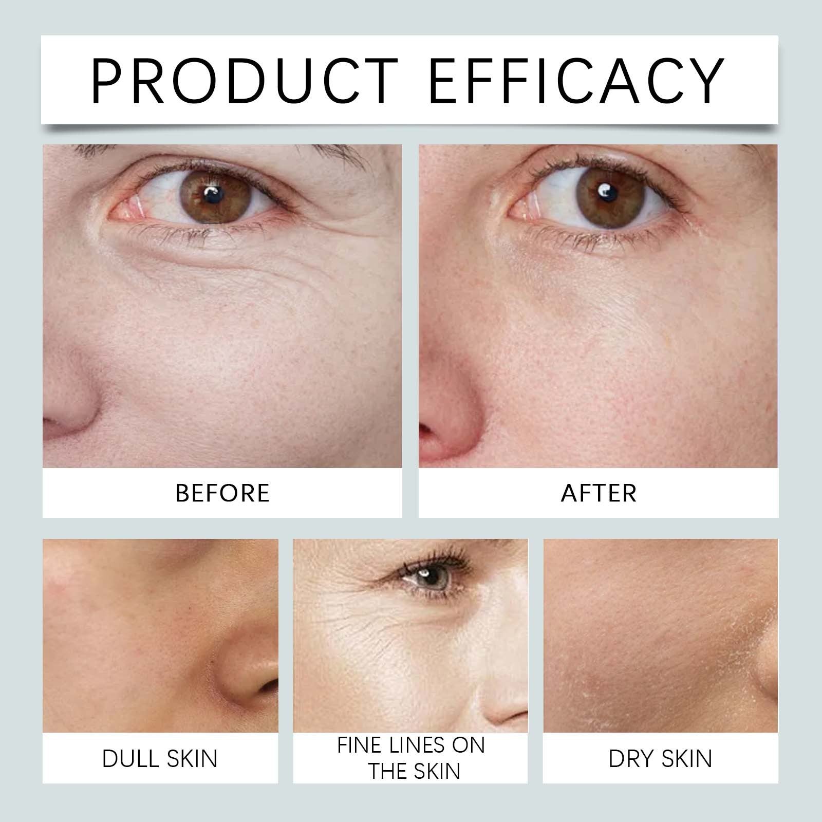 Anti-wrinkle Collagen Hydrating Mask - My Store