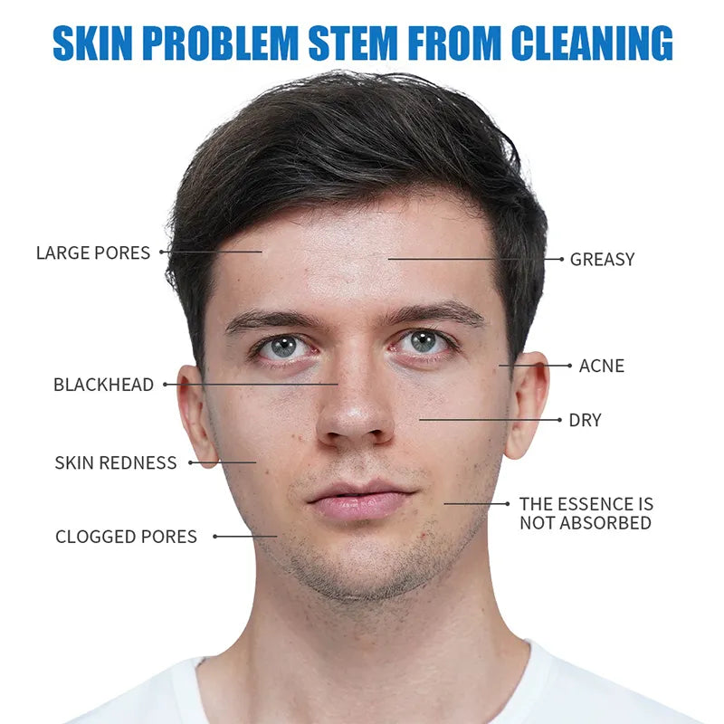 Oil Control And Acne Removing Mud Shrink Mask - My Store