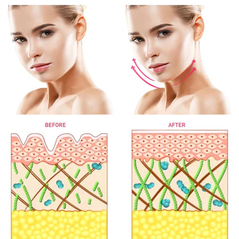 Micro Current Beauty Instrument - My Store